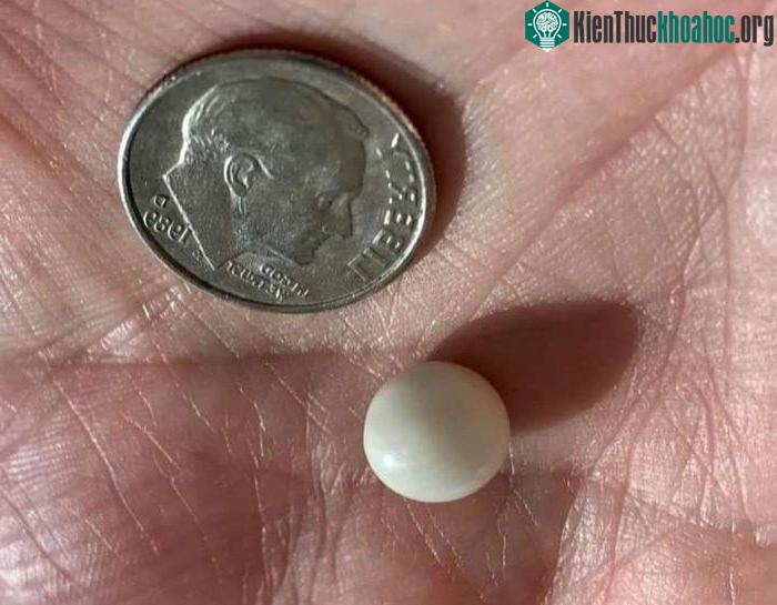 Ăn món khai vị bất ngờ phát hiện viên ngọc trai đắt giá.
