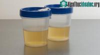 Ảnh Phát minh mới có thể biến nước tiểu thành điện năng