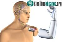 Ảnh Cánh tay robot cho người liệt toàn thân