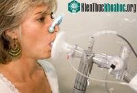 Ảnh Mũi điện tử nano có thể phát hiện nguy cơ gây ung thư dạ dày