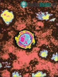 Ảnh Loại virus hiếm gây ra tử vong gần 100% bất ngờ "tái xuất"