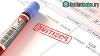 Ảnh Phát triển loại thuốc bằng chỉnh sửa gene có thể chữa khỏi HIV/AIDS?
