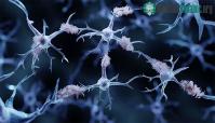 Ảnh Truyền máu sẽ mở ra được một hy vọng mới trong việc điều trị bệnh Alzheimer