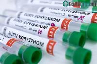 Ảnh Trường hợp người lây đậu mùa khỉ cho chó đầu tiên trên thế giới