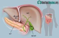 Ảnh Thực hư hiệu quả giải độc gan bằng các phương pháp dân gian