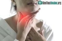 Ảnh Những nguyên nhân chính gây viêm họng, đau họng