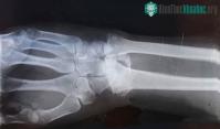 Ảnh Bí ẩn về những bộ xương khỏe nhất thế giới