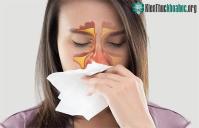 Ảnh Người viêm mũi dị ứng có 2 món không ăn - 3 món cần ăn nhiều để không khiến bệnh thêm trầm trọng