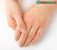 Ảnh Top 10 dấu hiệu từ cơ thể cho biết bạn đang bị thiếu khoáng chất, vitamin hoặc mắc bệnh nghiêm trọng