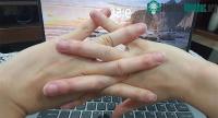Ảnh Thói quen bẻ khớp ngón tay, vặn cột sống, lắc cổ có gây thoái hóa sớm?