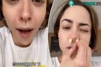 Ảnh Chữa cảm cúm bằng nhét tỏi vào mũi để làm sạch xoang: chuyên gia nói không tốt