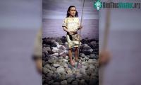 Ảnh Ngoại hình khác lạ của cậu bé dị tật sống cách đây 8.300 năm
