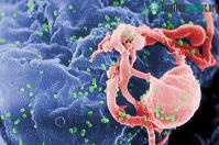 Ảnh Bệnh nhân thứ 3 đã chữa khỏi HIV nhờ ghép tế bào gốc