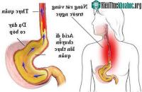 Ảnh Mẹo ăn uống nhằm hạn chế triệu chứng khó chịu, người bị trào ngược dạ dày - thực quản nên biết