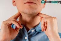 Ảnh Các nguyên nhân gây viêm họng kèm sưng hạch