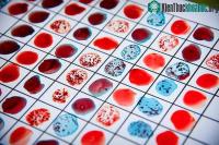 Ảnh Chế độ dinh dưỡng tác động đến gene như thế nào?