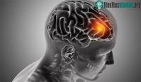 Ảnh Tìm được cách khiến tế bào ung thư não tự diệt