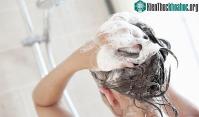 Ảnh Bao lâu nên gội đầu 1 lần? Bác sĩ có câu trả lời phụ thuộc vào 3 yếu tố này!