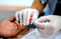 Ảnh Ai là người được phép lấy mẫu xét nghiệm HIV?