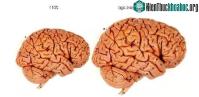 Ảnh Não người bị thu nhỏ là vì biến đổi khí hậu?