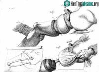 Ảnh Khám phá lịch sử thăng trầm của thuốc giảm đau và gây mê