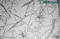 Ảnh Virus đầu tiên được nhà khoa học phát hiện là gì?