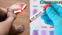 Ảnh 10 cách "đào thải" acid uric một cách tự nhiên, ngừa gout hiệu quả: Nhiều người chưa biết để làm!