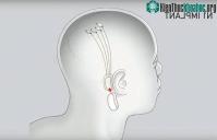 Ảnh Hàng nghìn người xếp hàng để được cấy chip vào não