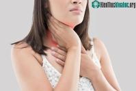 Ảnh Triệu chứng bệnh suy giáp theo từng độ tuổi
