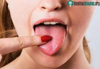 Ảnh Nguyên nhân gây ra hiện tượng chua miệng?
