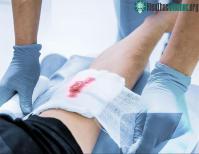 Ảnh Nghiên cứu đột phá về phương pháp điều trị hiệu quả những vết thương lâu lành