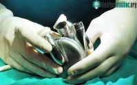 Ảnh Úc phát triển thiết bị cấy ghép tim đột phá, mở ra hy vọng mới cho những bệnh nhân suy tim