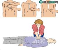 Ảnh Xử lý sao với các tình huống nguy cấp về tim mạch, đột quỵ?