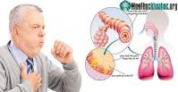 Ảnh Hướng dẫn 5 giải pháp giảm khó thở do không khí lạnh tăng cường