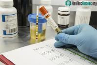 Ảnh Phát triển thiết bị xét nghiệm phát hiện 40 loại chất ma túy chỉ trong 3 phút