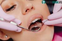 Ảnh Những điều ít người biết về sâu răng