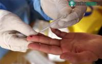 Ảnh AI phát hiện ra 3 bệnh ung thư nguy hiểm chỉ với một giọt máu khô