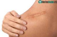 Ảnh Những nhà khoa học Bỉ phát hiện đột phá về quá trình liền sẹo