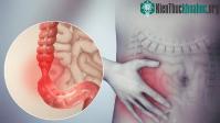 Ảnh Dấu hiệu nhận biết về bệnh viêm ruột