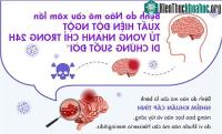 Ảnh Bệnh do não mô cầu xâm lấn có thể dẫn đến tử vong trong 24 giờ