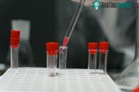 Ảnh Australia đã làm thất lạc 300 lọ virus nguy hiểm gây chết người