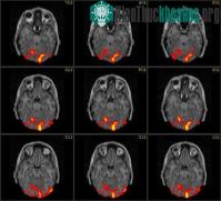 Ảnh Những bí ẩn về khuôn mặt con người