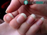 Ảnh Nguyên nhân móng tay mọc nhanh hơn móng chân