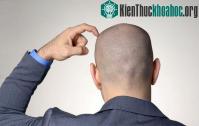 Ảnh Làm gì đó luôn tốt hơn là ngồi không