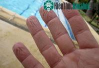 Ảnh Vì sao tay người trẻ bị nhăn khi ngâm nước, tay người già thì không?