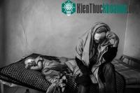 Ảnh Quá trình axit đậm đặc phá hủy cơ thể con người