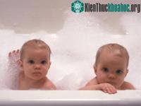 Ảnh Những điều thú vị về cặp song sinh mà có thể bạn chưa biết