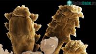 Ảnh Demodex - Loài rận chuyên ký sinh trên... da mặt người