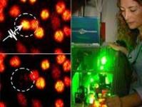 Ảnh Dao laser diệt từng tế bào ung thư