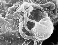 Ảnh Quay phim trực tiếp lúc virus HIV ra đời